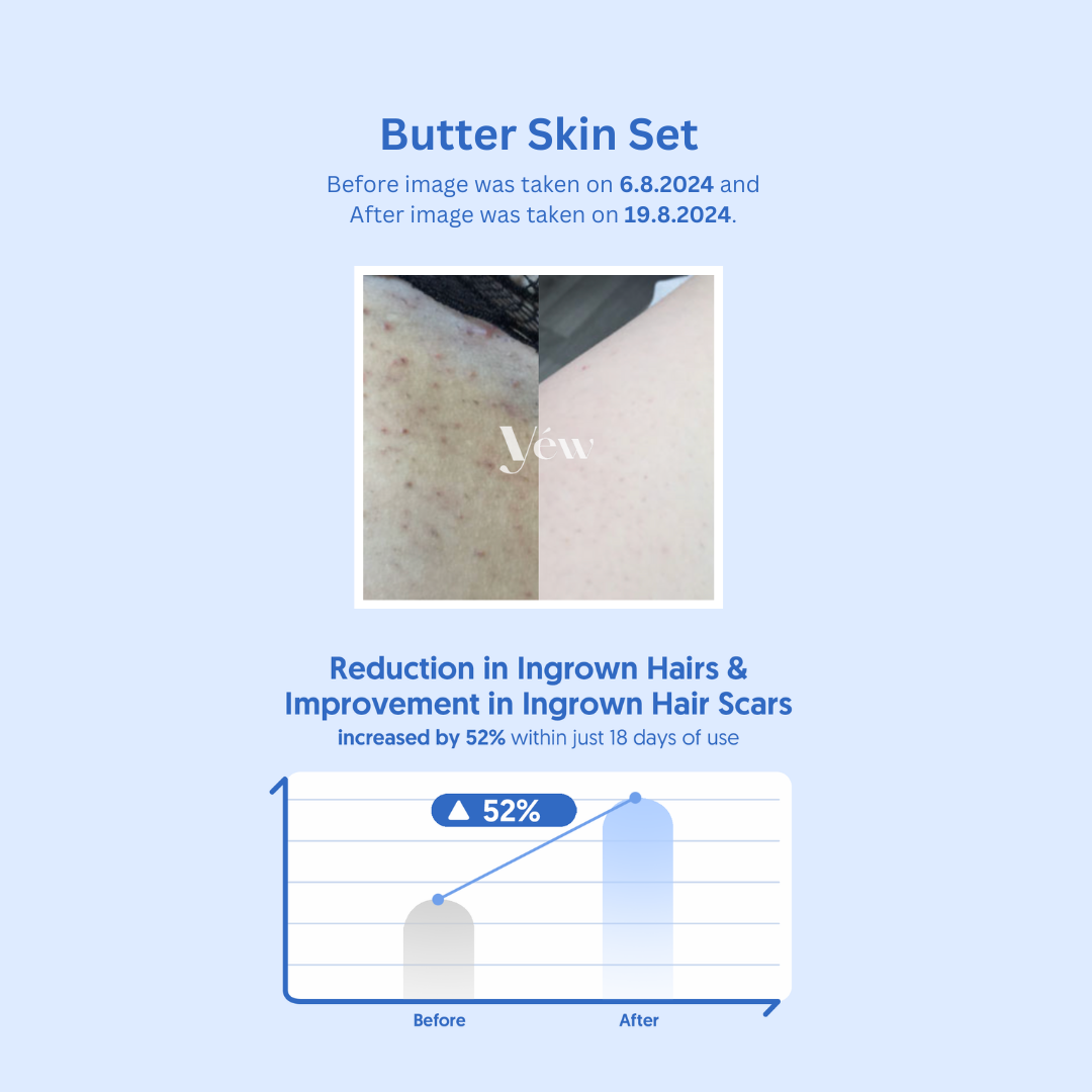 Butter Skin Set