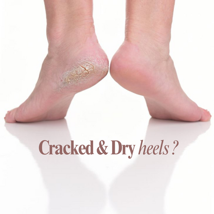 Instant Repair Heel Balm