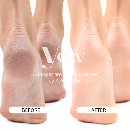 Instant Repair Heel Balm