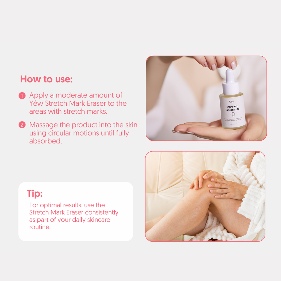 Stretch Mark Concentrate