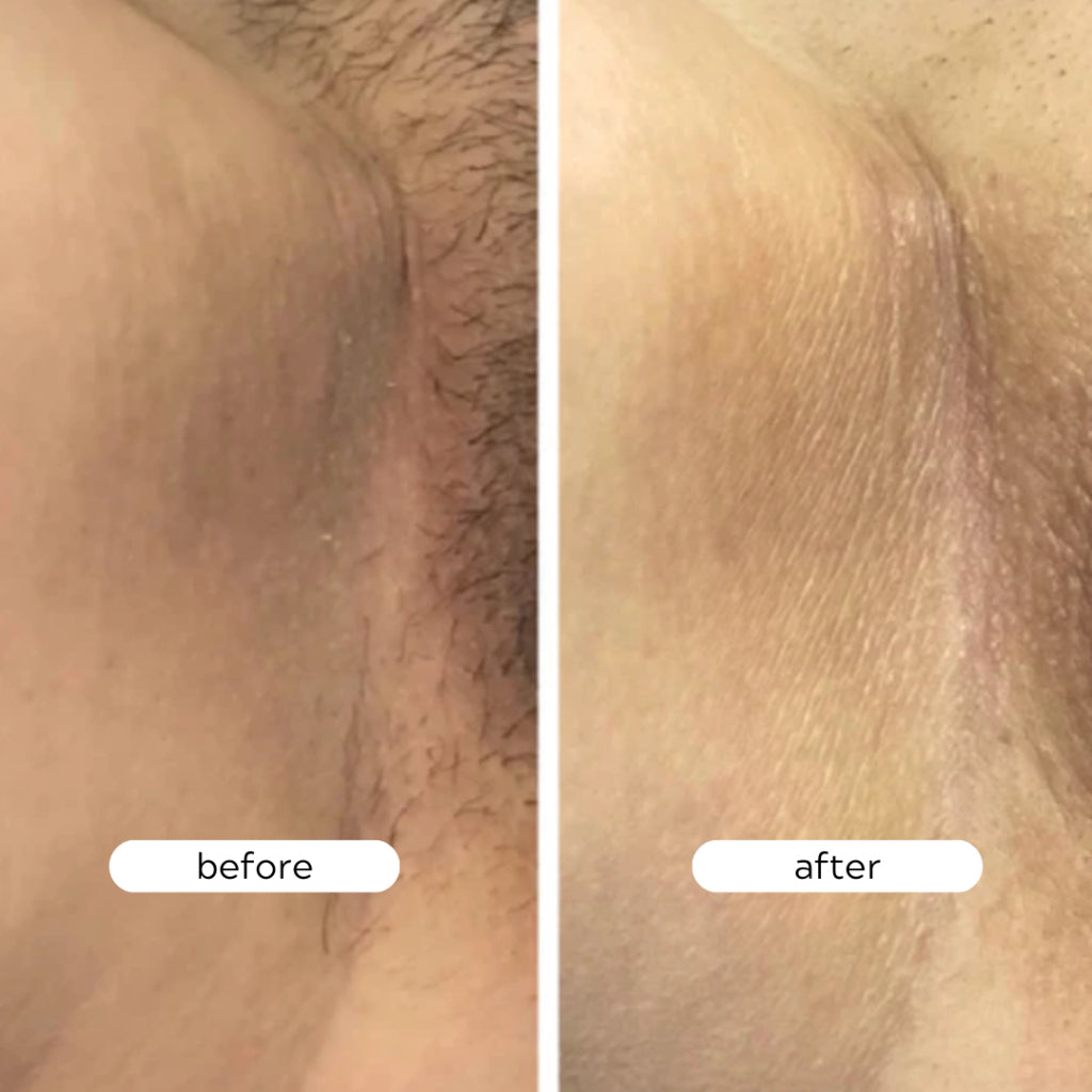 Plump & Brighten Intimate Care