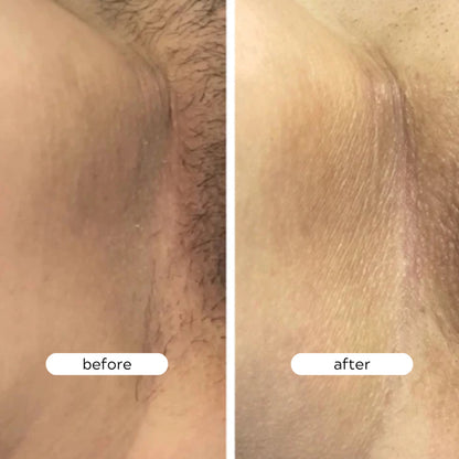 Plump & Brighten Intimate Care